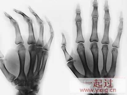 盘点人体已被破解的十三个怪现象(图)