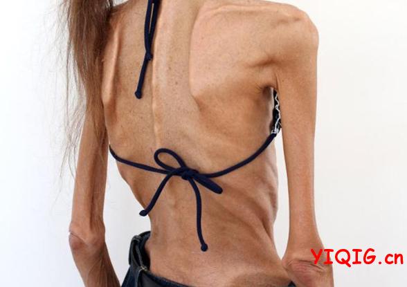 男女太瘦的风险有哪些