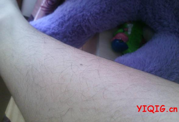 冷光脱毛的原理及优势